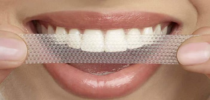 Whitening Strips